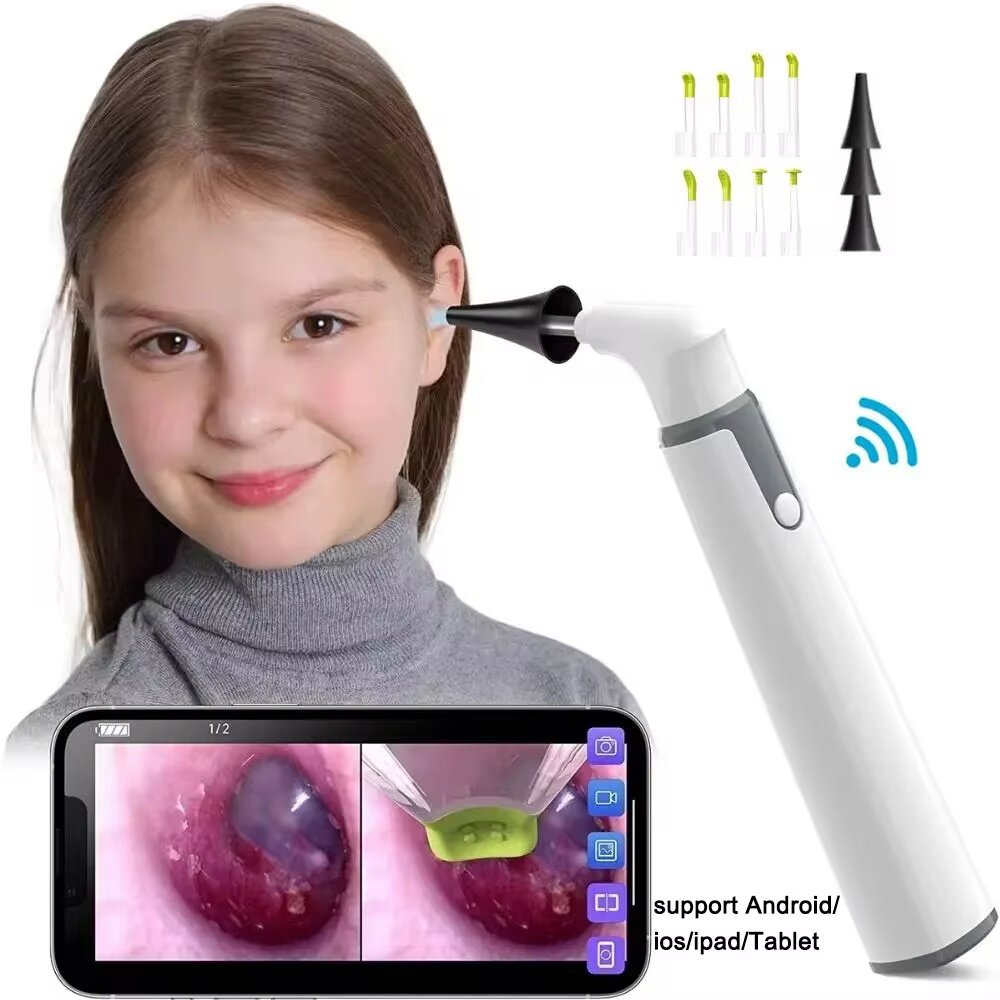 90295f03-b3b5-43a6-a440-d8ba988d14e4.jpg Wireless Otoscope Ear Camera 3.9mm 1080P HD WiFi Ear Scope with 6 LED Lights for Kids and Adults Support Android iOS Phone